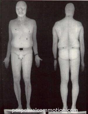 Full-body scan image of a man